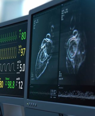 Cardiac scoring test