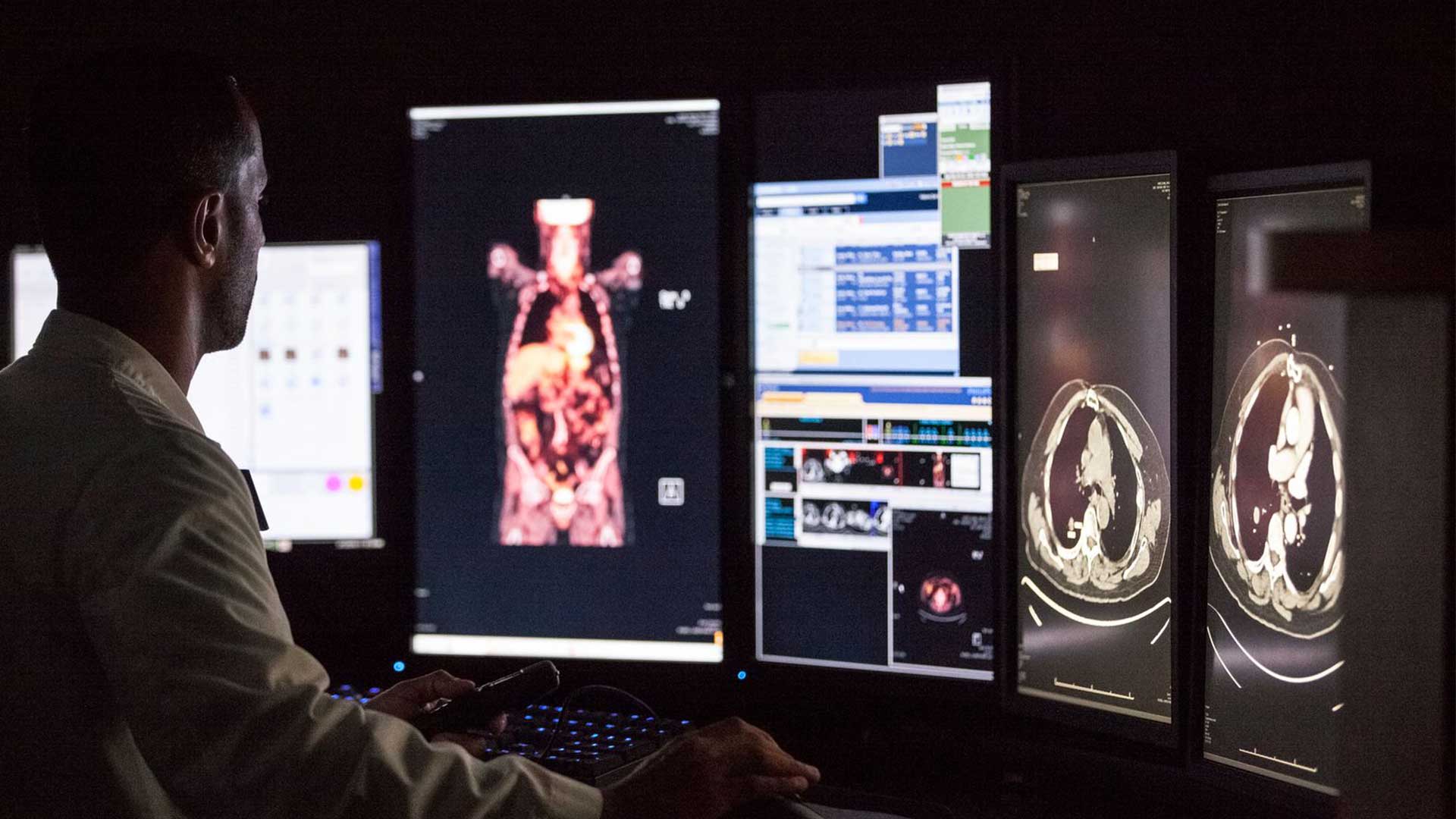 CT scan images which can be used to help detect cancer