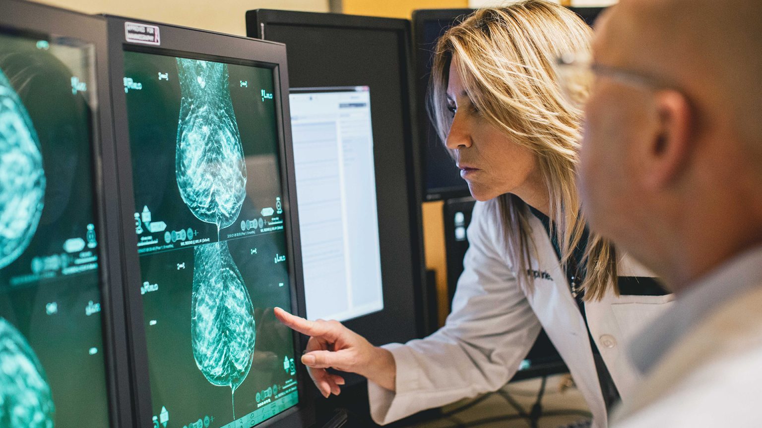 Diagnostic Mammogram What to Expect When You Are Called Back