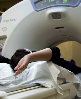 Photo of someone having a CT scan, used to explain a lung cancer screening via low-dose lung CT scan