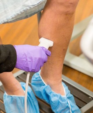 An image of a person that may have venous disease having a treatment administered to them by a vein specialist