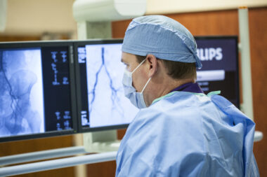 An interventional radiologist looks at monitors with scan information, used to explain imaging's role in aneurysm treatment